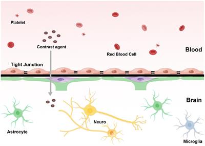 Application of magnetic resonance imaging-related techniques in the diagnosis of sepsis-associated encephalopathy: present status and prospect